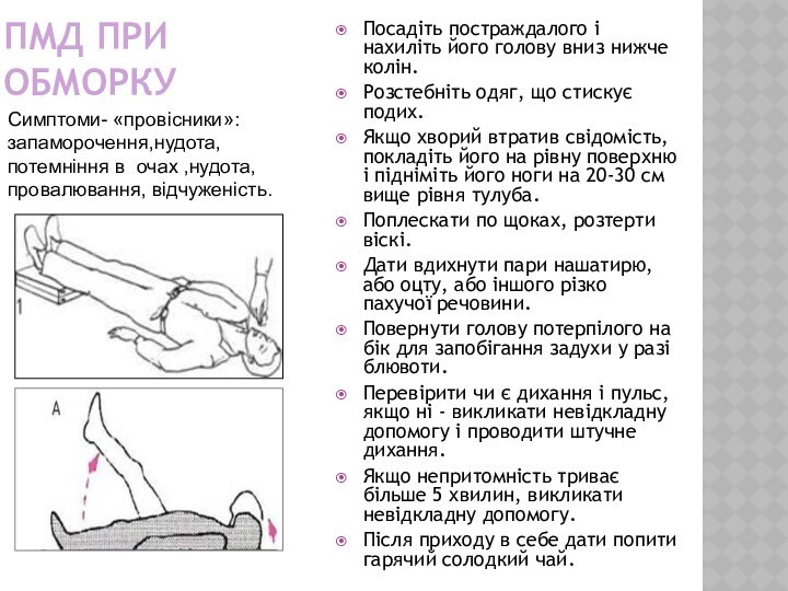 ПМд при  Обморку