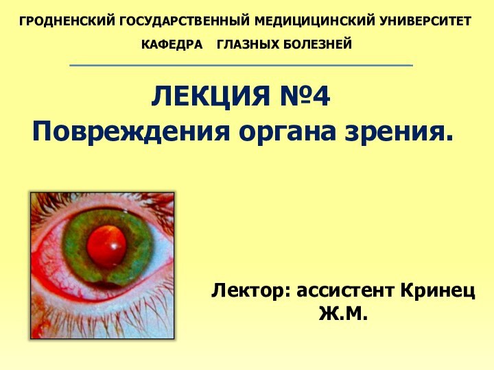 ГРОДНЕНСКИЙ ГОСУДАРСТВЕННЫЙ МЕДИЦИЦИНСКИЙ УНИВЕРСИТЕТКАФЕДРА  ГЛАЗНЫХ БОЛЕЗНЕЙЛЕКЦИЯ №4Повреждения органа зрения.Лектор: ассистент Кринец Ж.М.