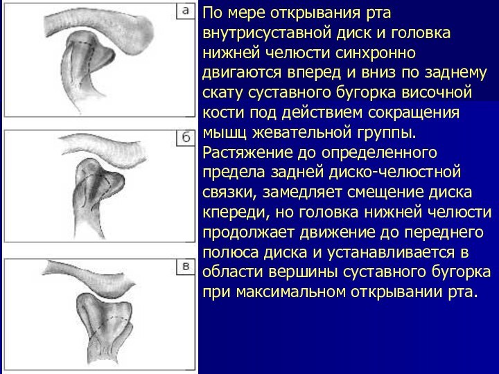 По мере открывания рта внутрисуставной диск и головка нижней челюсти синхронно двигаются