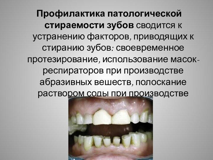 Профилактика патологической стираемости зубов сводится к устранению факторов, приводящих к стиранию зубов: своевременное