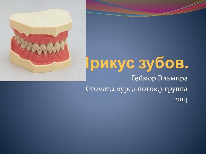 Прикус зубов.Геймор ЭльмираСтомат,2 курс,1 поток,3 группа2014