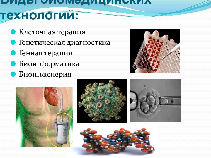 Виды биомедицинских технологий:Клеточная терапияГенетическая диагностикаГенная терапияБиоинформатикаБиоинженерия