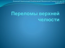 Переломы верхней челюсти