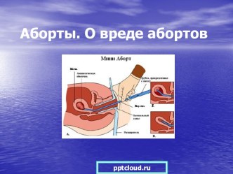 Аборты. О вреде абортов