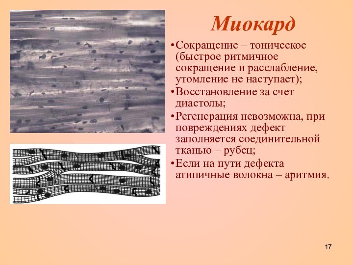 МиокардСокращение – тоническое (быстрое ритмичное сокращение и расслабление, утомление не наступает);Восстановление за