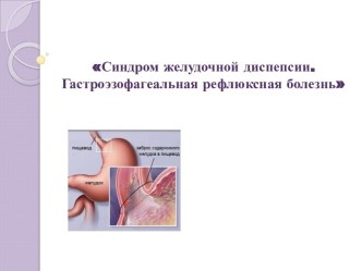 Синдром желудочной диспепсии. Гастроэзофагеальнаярефлюксная болезнь