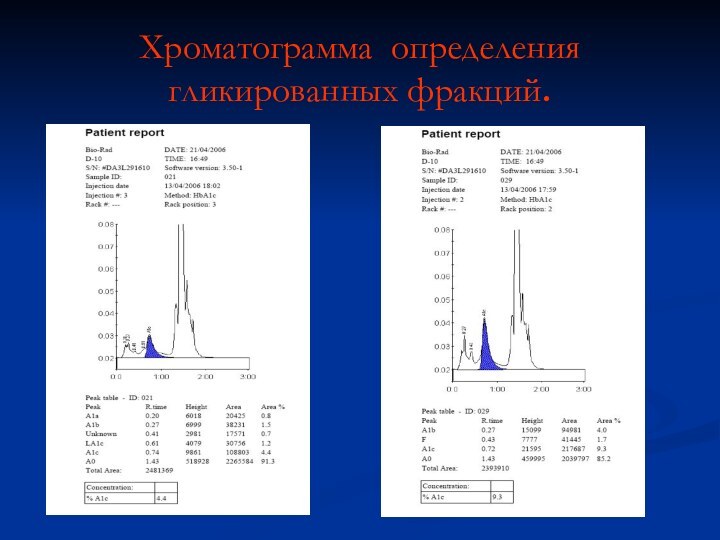 Хроматограмма определения гликированных фракций.