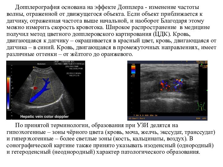 Допплерография основана на эффекте Допплера - изменение частоты волны, отраженной от движущегося