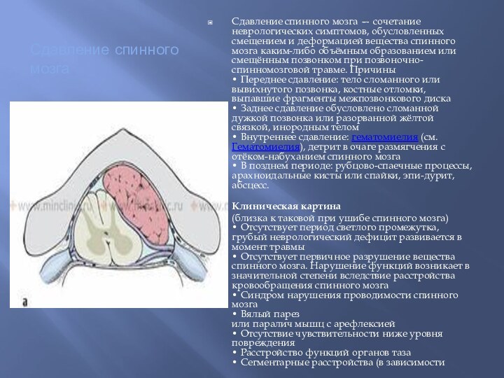 Сдавление спинного мозга •Сдавление спинного мозга — сочетание неврологических симптомов, обусловленных смещением