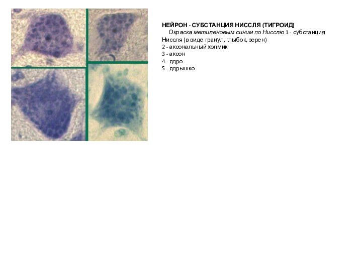 НЕЙРОН - СУБСТАНЦИЯ НИССЛЯ (ТИГРОИД)      Окраска метиленовым синим по Нисслю 1