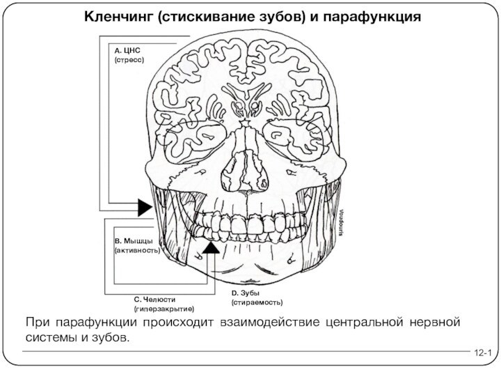 12-1Кленчинг (стискивание зубов) и парафункцияПри парафункции происходит взаимодействие центральной нервной системы и зубов.