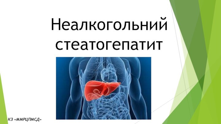 Неалкогольний стеатогепатитКЗ «ММРЦПМСД»