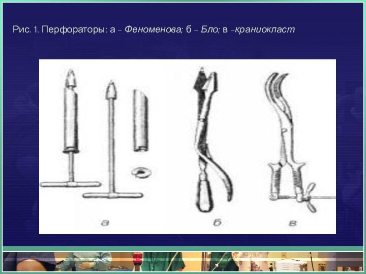 Рис. 1. Перфораторы: а - Феноменова; б - Бло; в -краниокласт