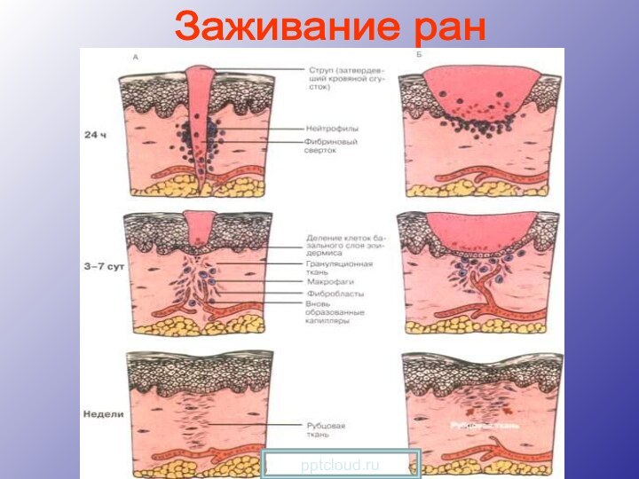 Заживание ран