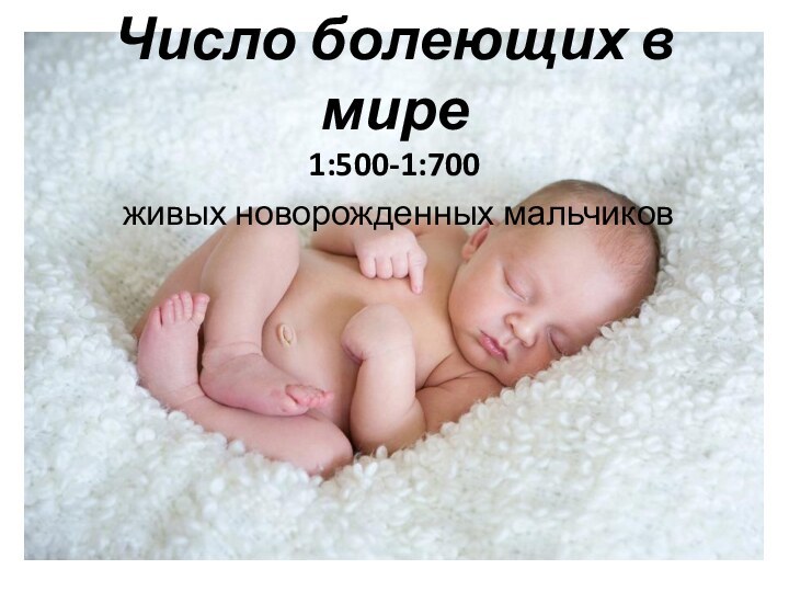 Число болеющих в мире1:500-1:700 живых новорожденных мальчиков
