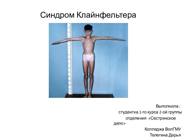 Синдром Клайнфельтера