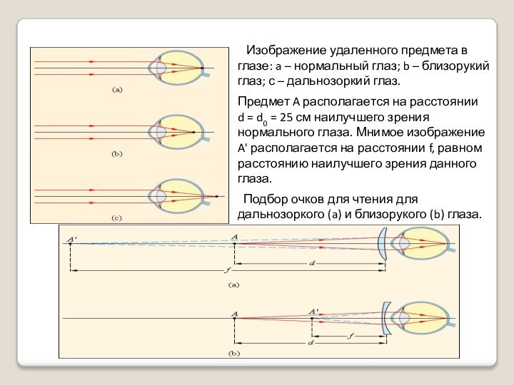 Изображение удаленного предмета в глазе: a – нормальный глаз; b – близорукий глаз; с – дальнозоркий