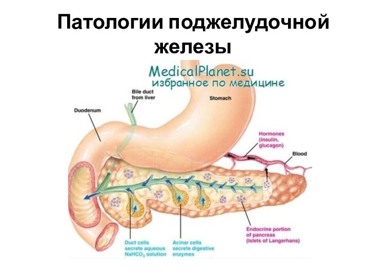 Патологии поджелудочной железы