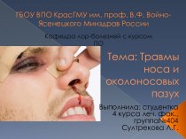 Тема: Травмы носа и околоносовых пазух
