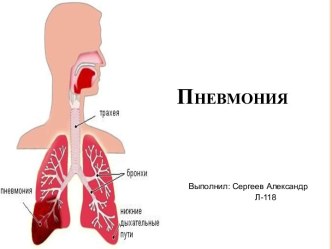 Пневмония