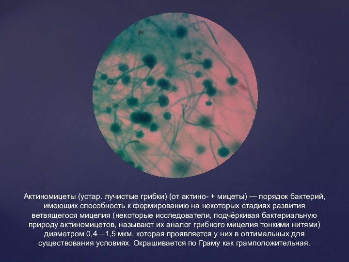 Актиномицеты (устар. лучистые грибки) (от актино- + мицеты) — порядок бактерий, имеющих