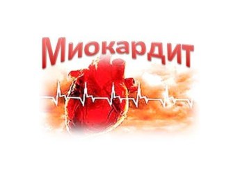 Миокардит