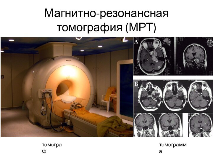 Магнитно-резонансная томография (МРТ)томографтомограмма