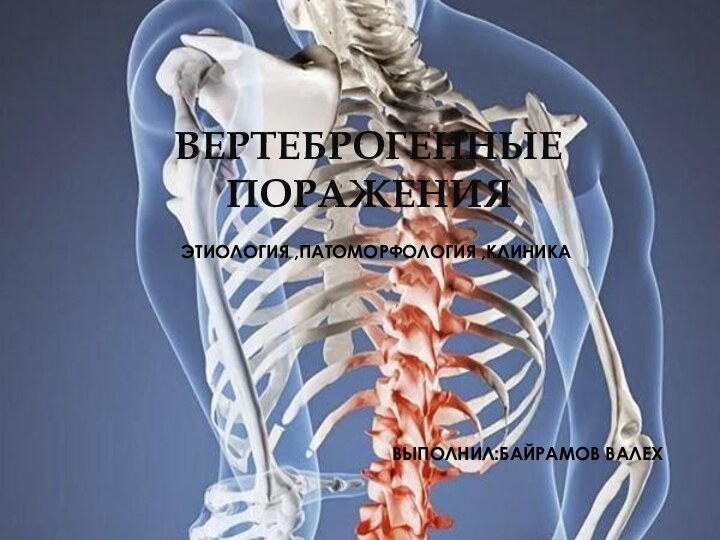 Этиология ,патоморфология ,клиникаВыполнил:Байрамов Валех Вертеброгенные поражения