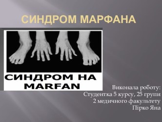 Синдром марфана