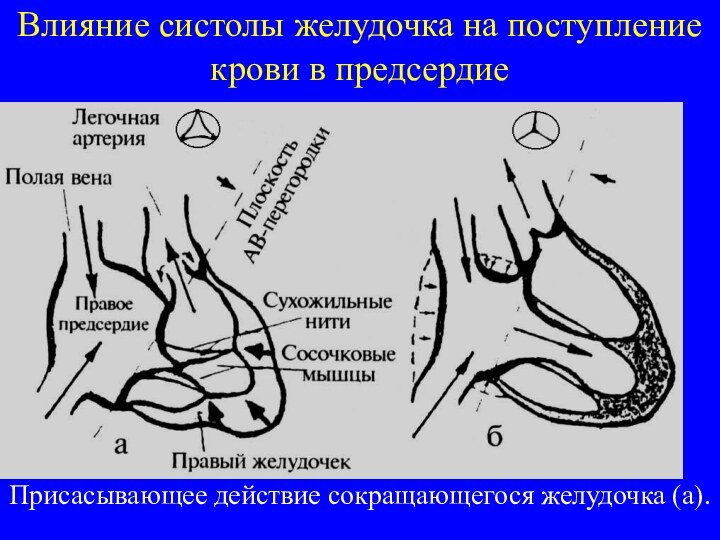 Влияние систолы желудочка на поступление крови в предсердиеПрисасывающее действие сокращающегося желудочка (а).