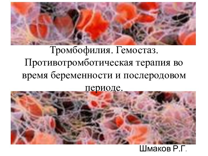 Тромбофилия. Гемостаз. Противотромботическая терапия во время беременности и послеродовом периоде. Шмаков Р.Г.