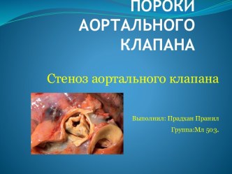 ПОРОКИ АОРТАЛЬНОГО КЛАПАНА