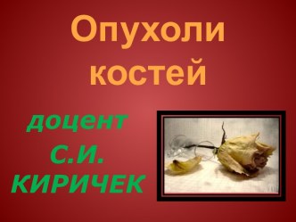 Опухоли костей