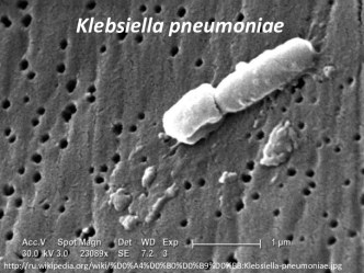 Klebsiella pneumoniae