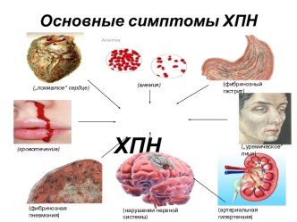 Основные симптомы ХПН