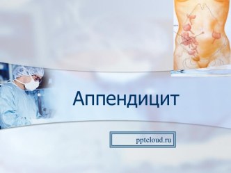 Аппендицит