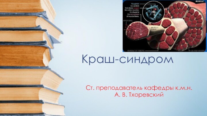 Краш-синдромСт. преподаватель кафедры к.м.н. А. В. Тхоревский