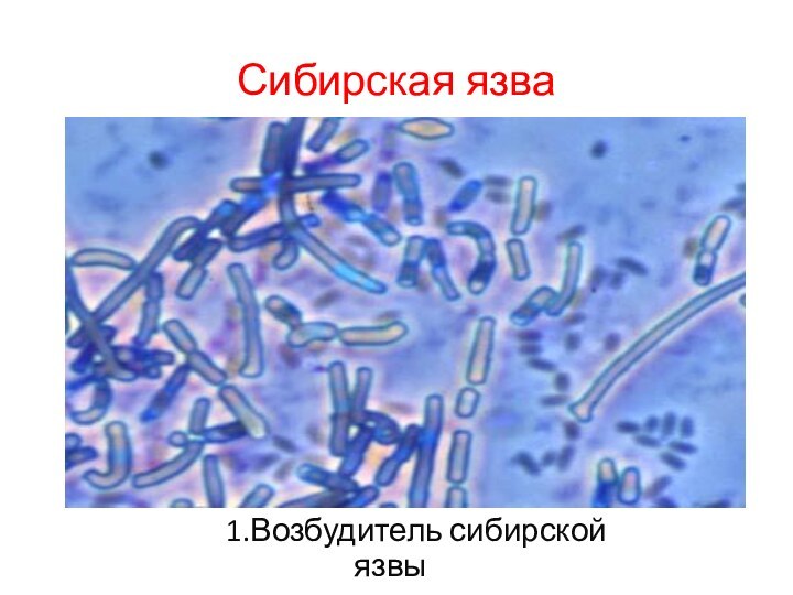 Сибирская язва    1.Возбудитель сибирской язвы