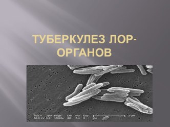 Туберкулез ЛОР-органов