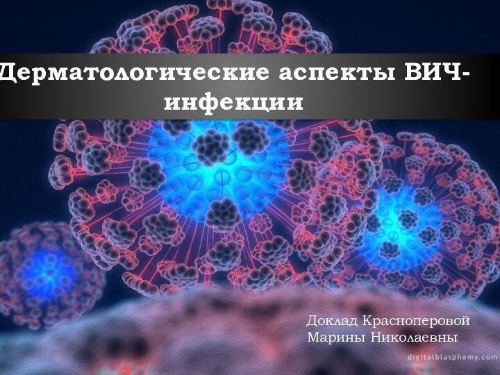 Дерматологические аспекты ВИЧ-инфекцииДоклад Красноперовой Марины Николаевны