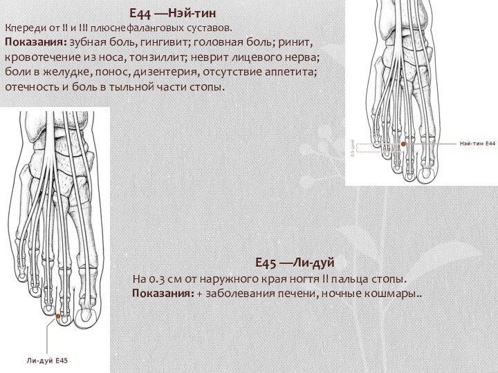 E44 —Нэй-тин Кпереди от II и III плюснефаланговых суставов. Показания: зубная боль,