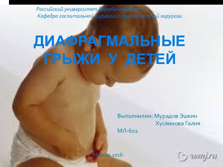 Диафрагмальные грыжи у детейВыполнилии: Мурадов Эшкин