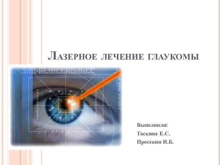 Лазерное лечение глаукомыВыполнили: Таскина Е.С.Просекин И.Б.