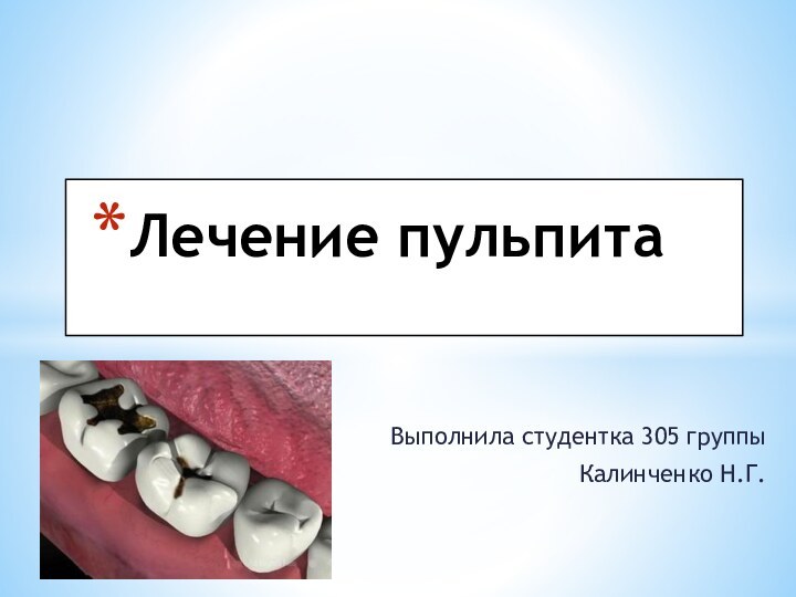 Выполнила студентка 305 группыКалинченко Н.Г.Лечение пульпита