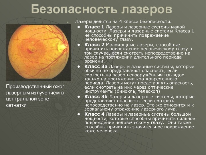 Безопасность лазеров Лазеры делятся на 4 класса безопасности.Класс 1 Лазеры и лазерные