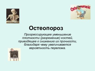 Остеопороз