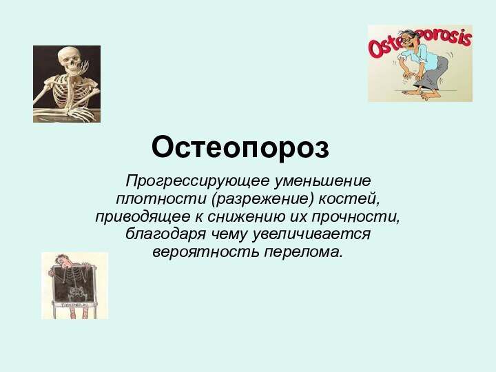 ОстеопорозПрогрессирующее уменьшение плотности (разрежение) костей, приводящее к снижению их прочности, благодаря чему увеличивается вероятность перелома.