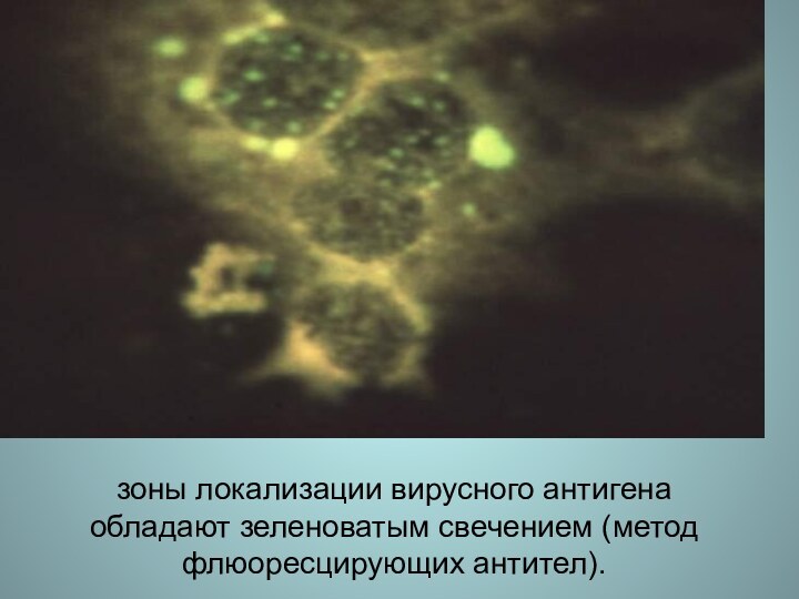 зоны локализации вирусного антигена обладают зеленоватым свечением (метод флюоресцирующих антител).
