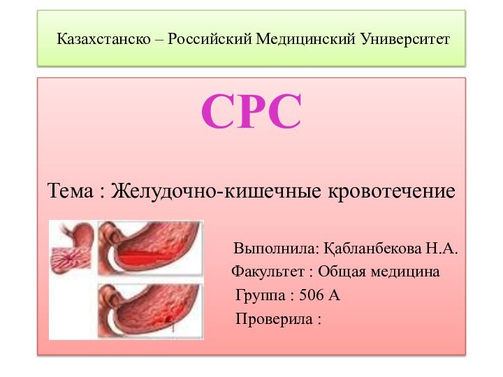 Казахстанско – Российский Медицинский Университет СРС	Тема : Желудочно-кишечные кровотечение