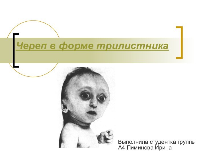 Череп в форме трилистника Выполнила студентка группы А4 Пиминова Ирина